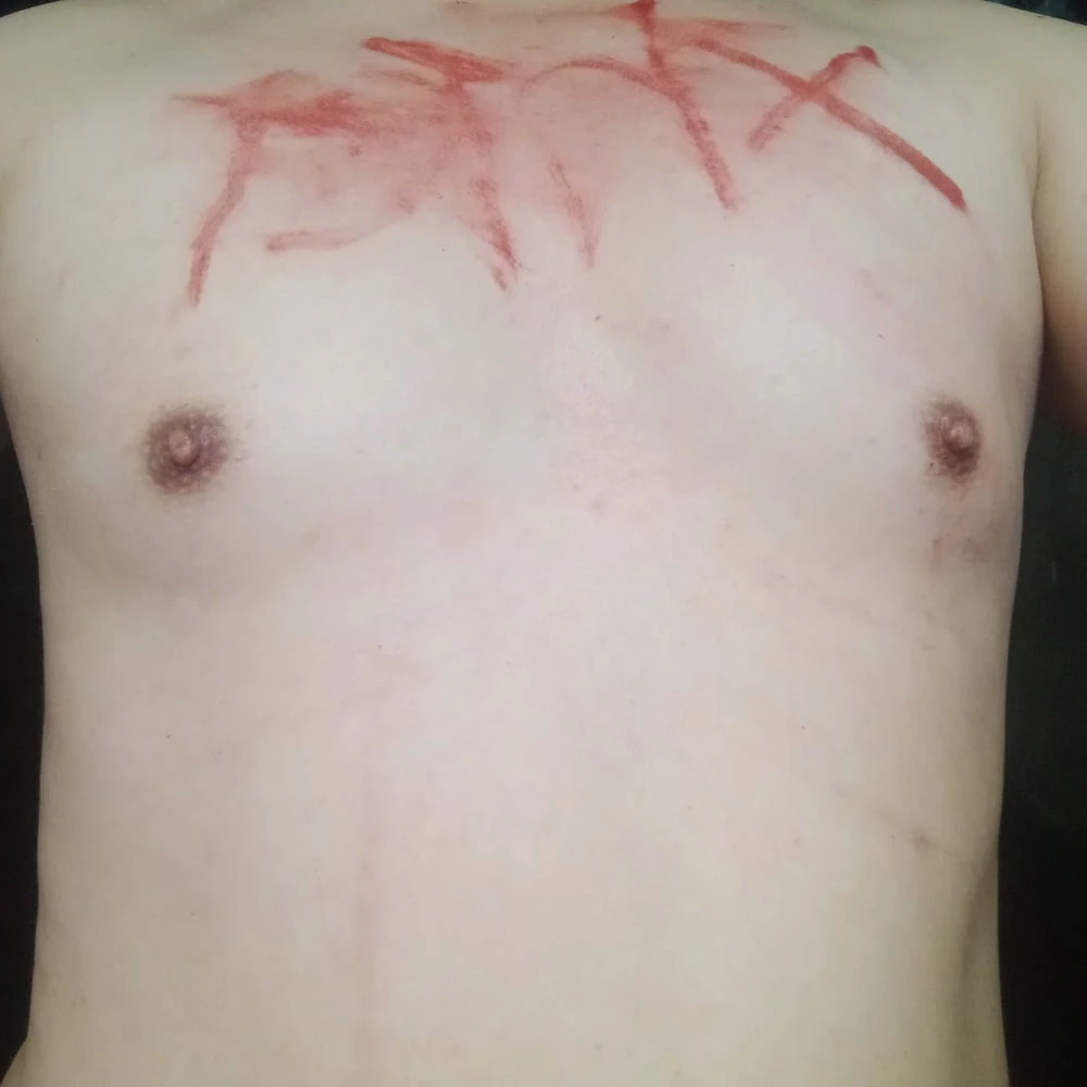 bondage