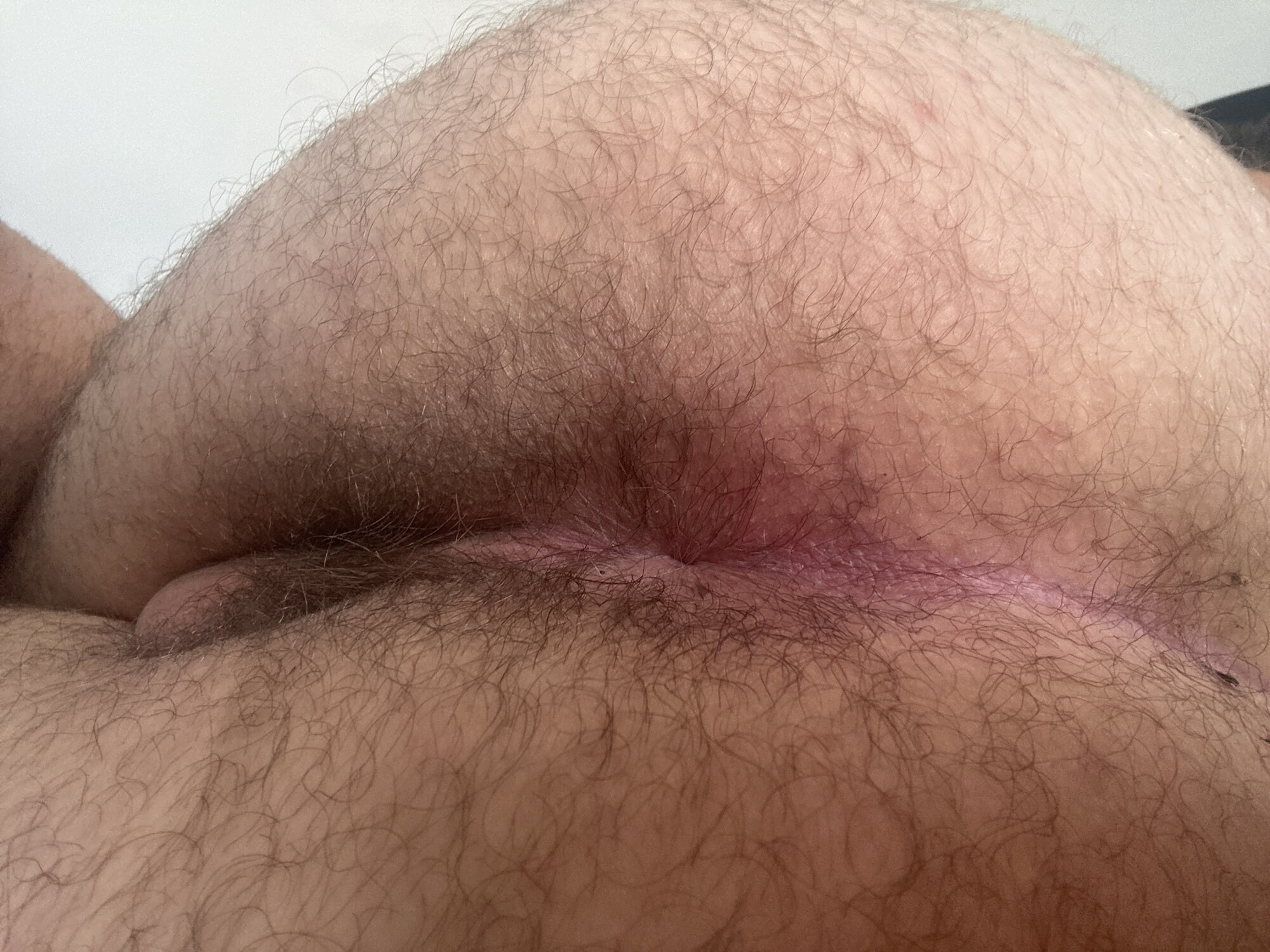 More asshole pics 