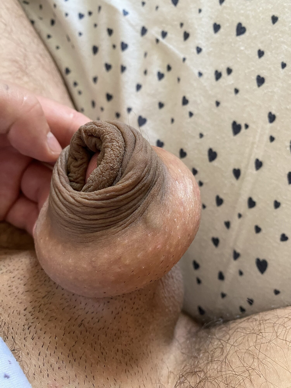 Foreskin extreme bondage #5