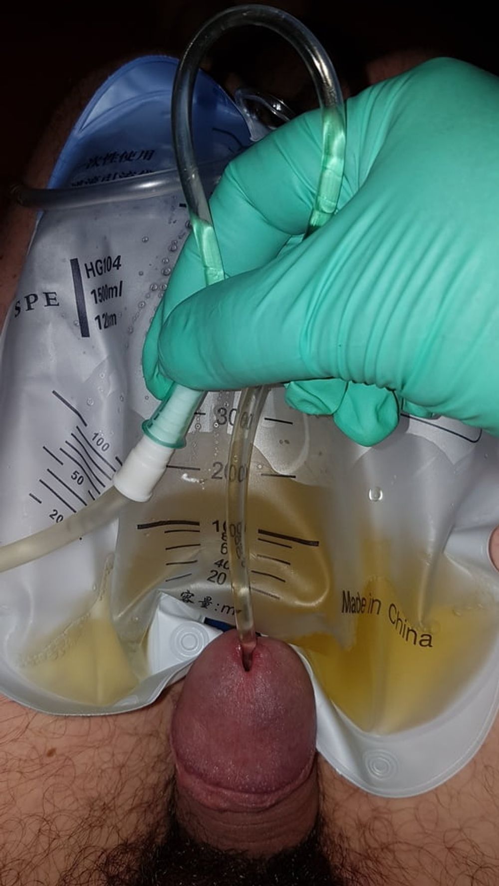 Catheter sounding with my urine 2 #19