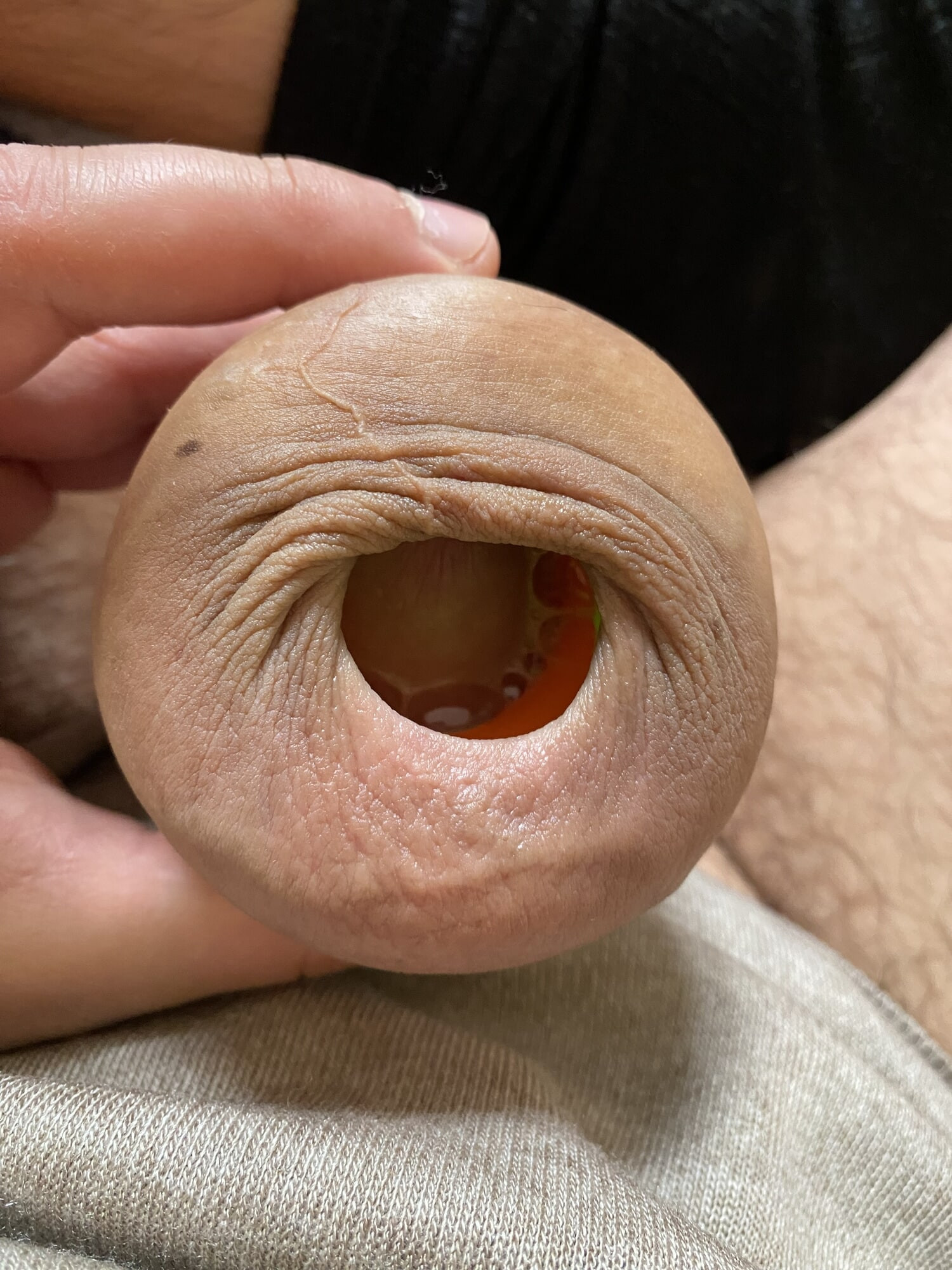 Foreskin stretching ring porn