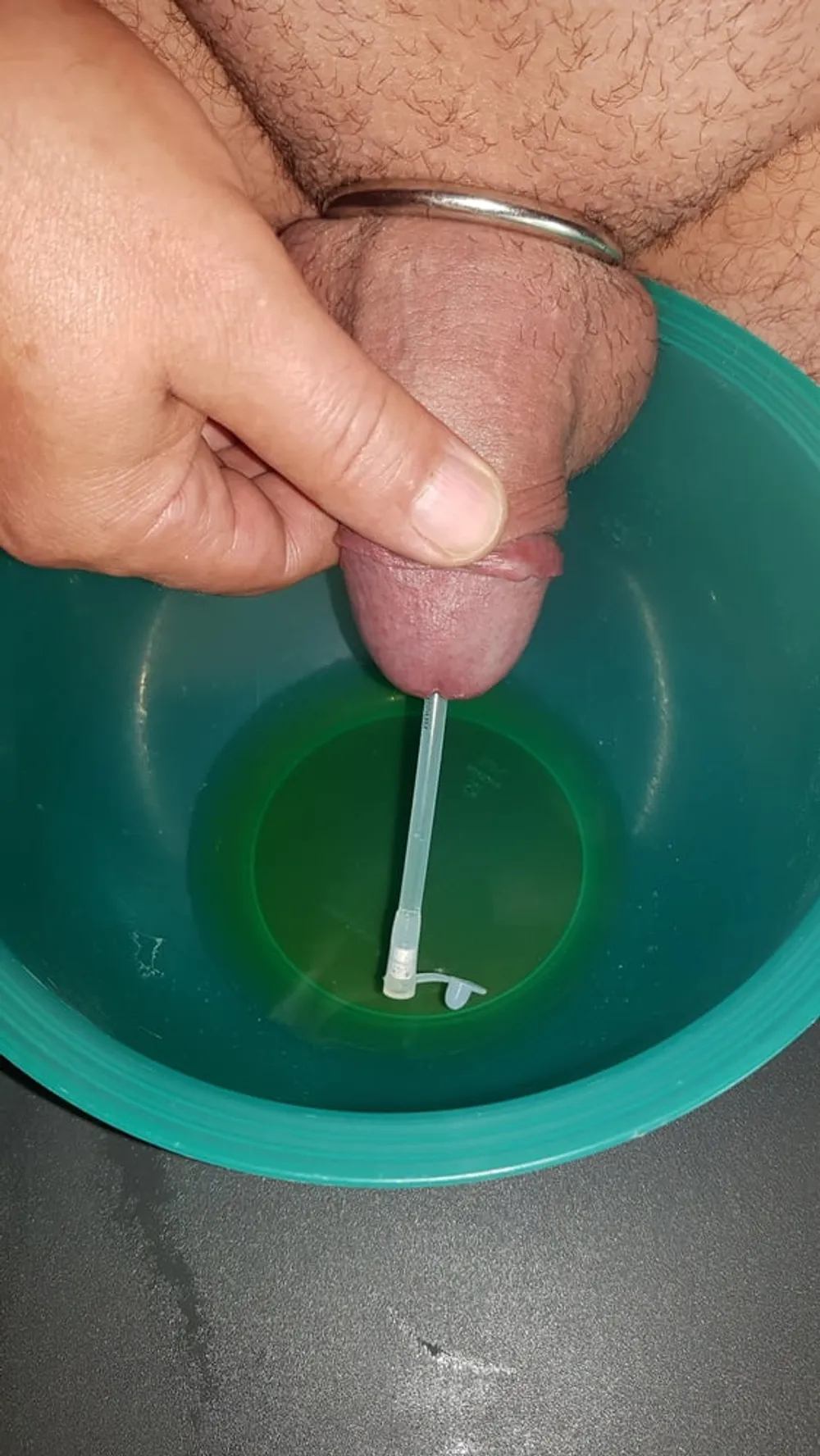 Catheter sounding with my urine #3