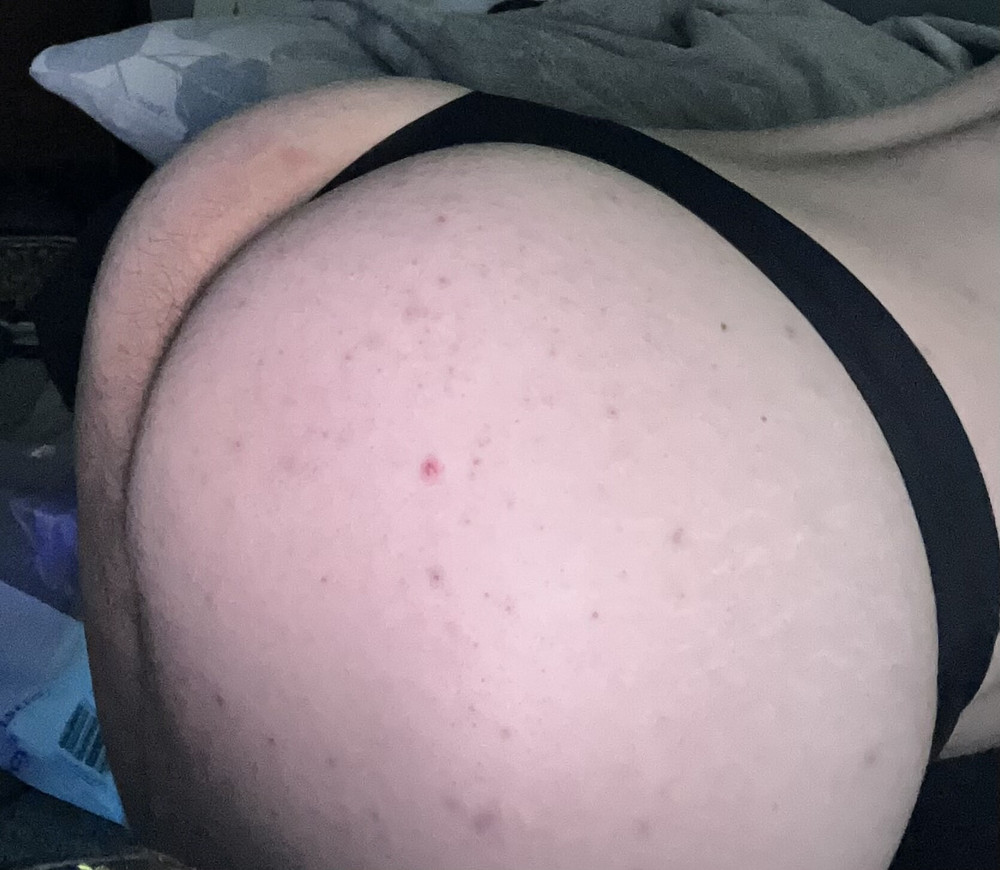 My fat ass in panties #22