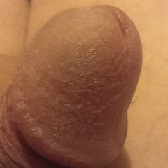 Close up