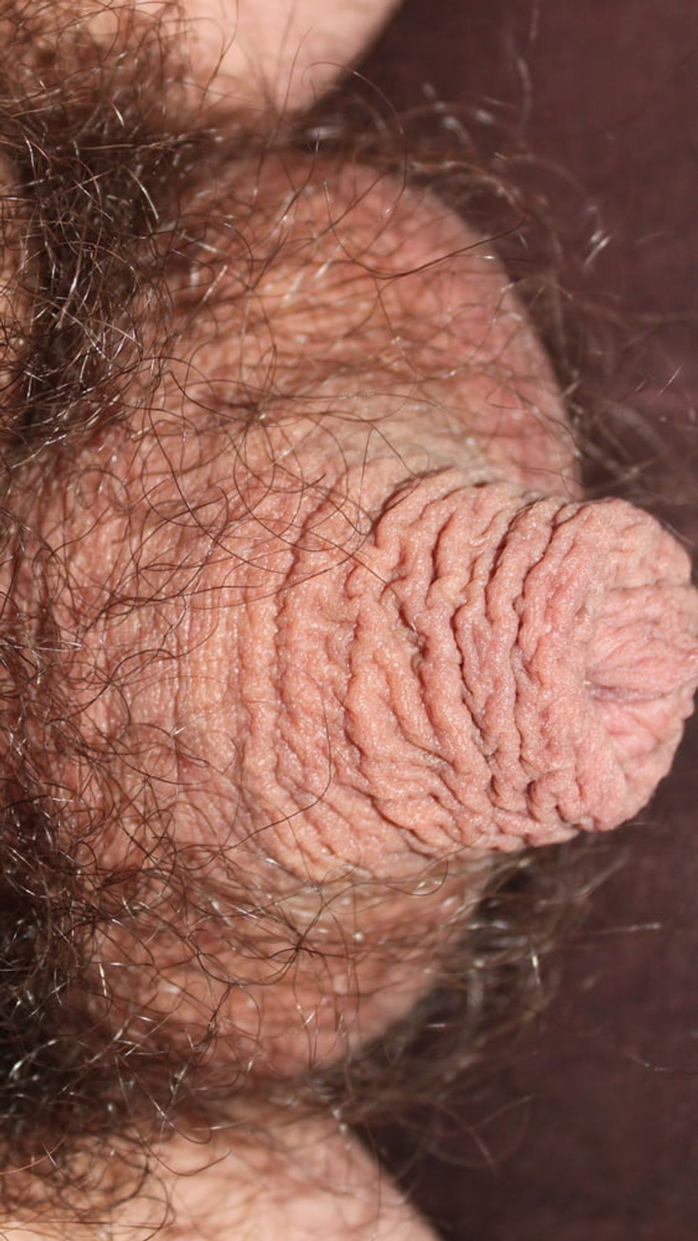 My foreskin #35