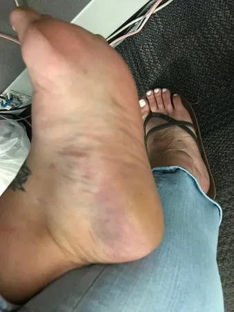 bbw flat feet         