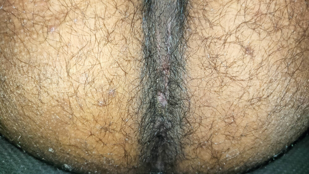 Hairy Cock and Ass 2 #9