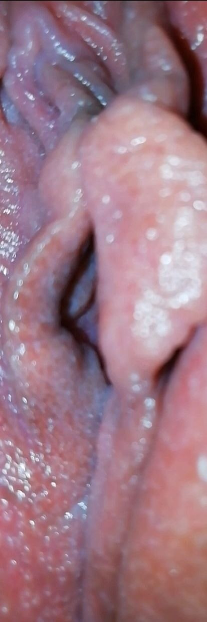  Zusammenstellung 5 #15