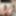 Zooming anus #4