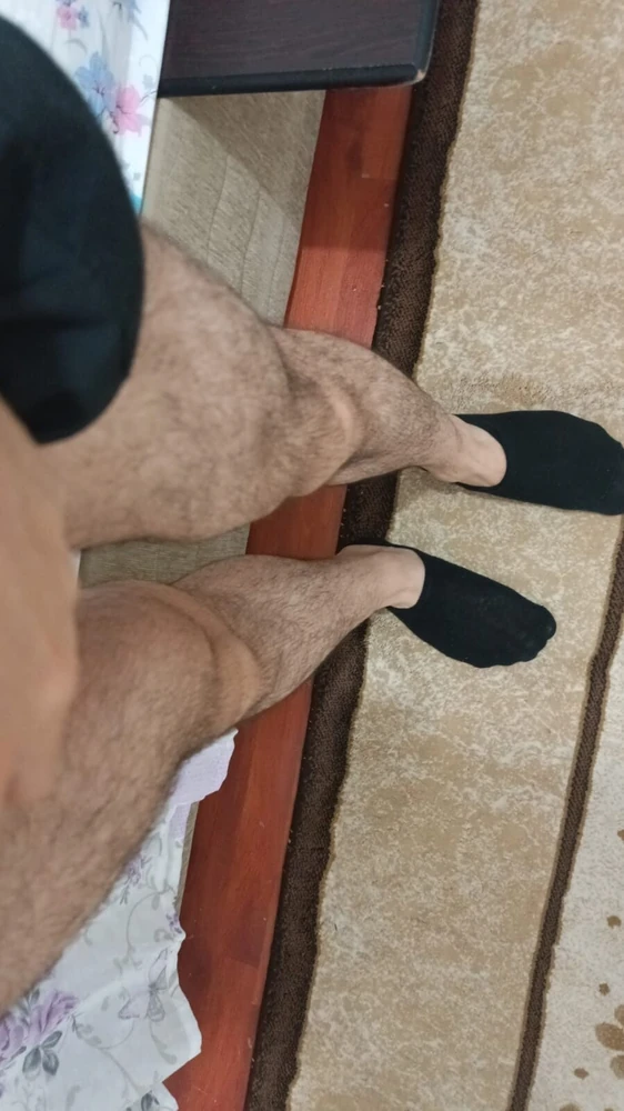  hairy leg