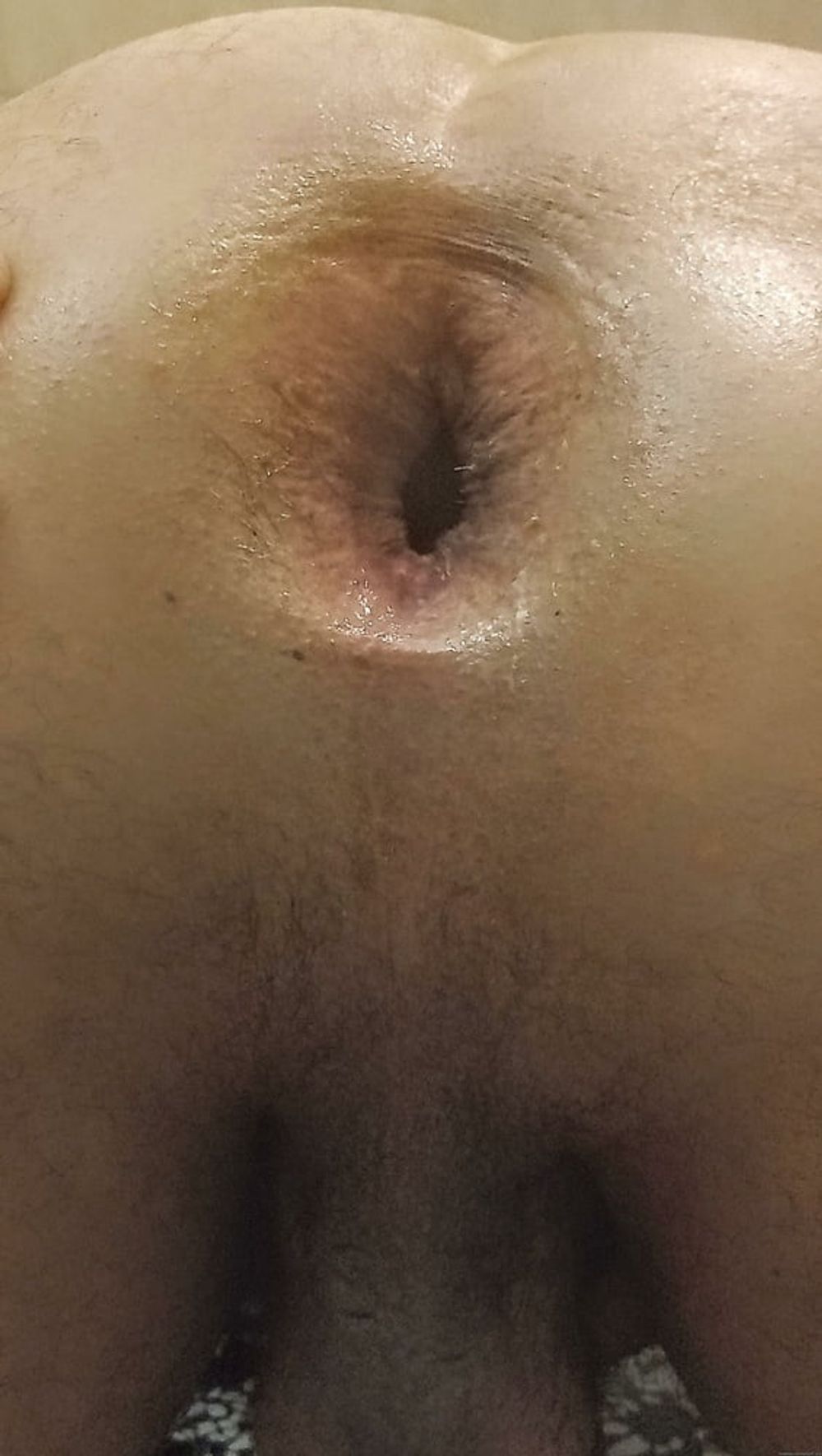 My ass (Opened) #31