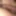 Dick