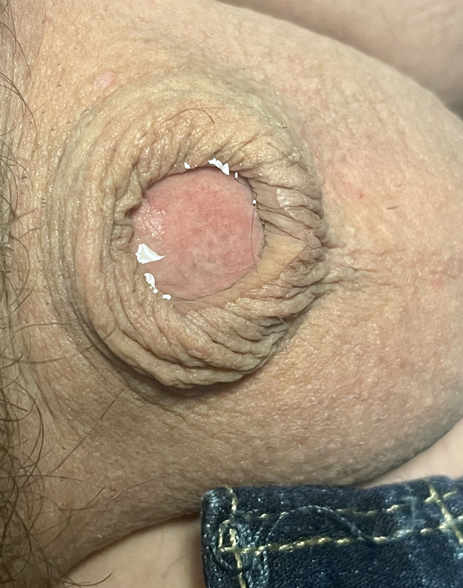 Inverted micro penis tiny dick pre cum