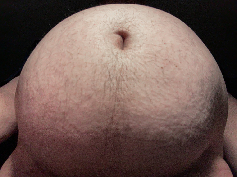 Ximd9000 #10