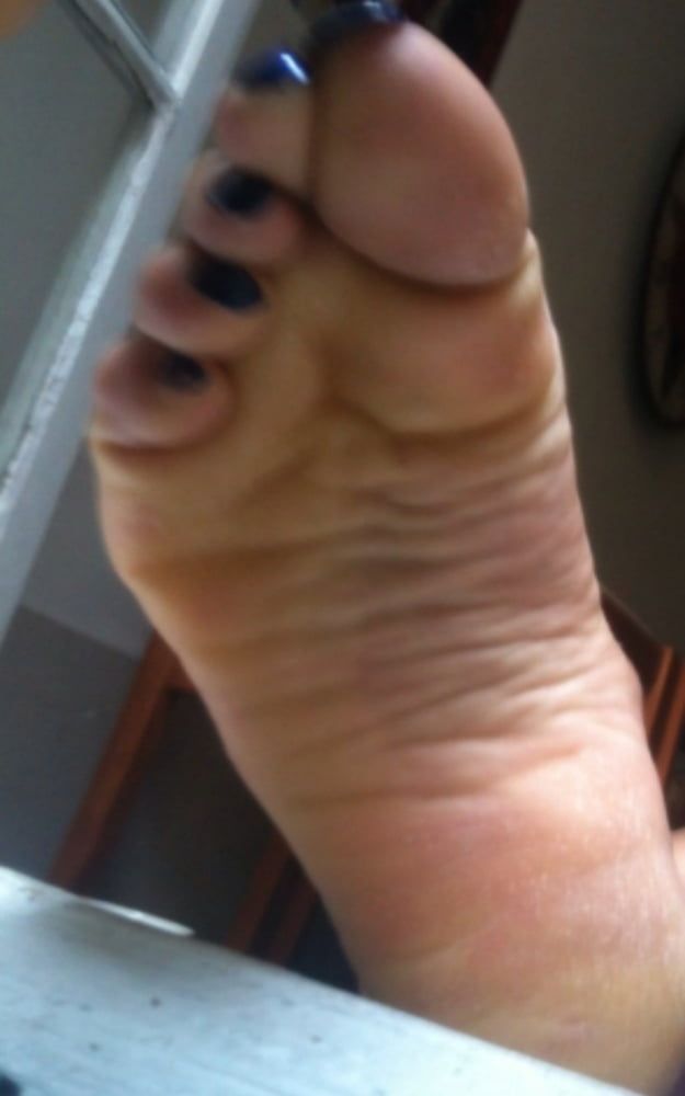 blue toenails and soles feet after day at beach  #19