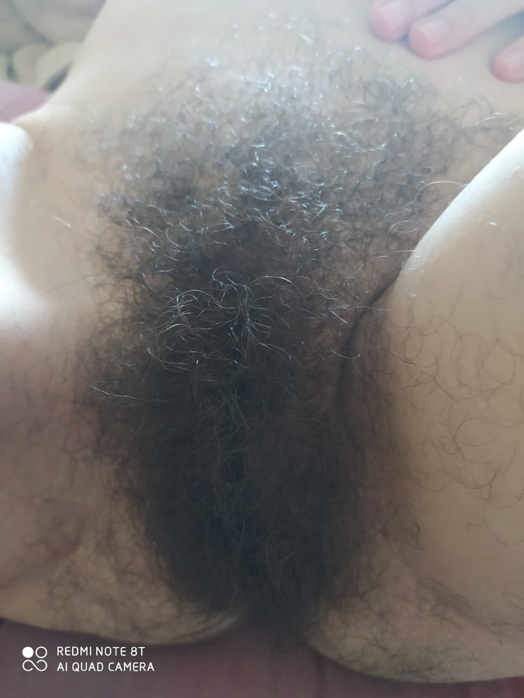 hairy #43