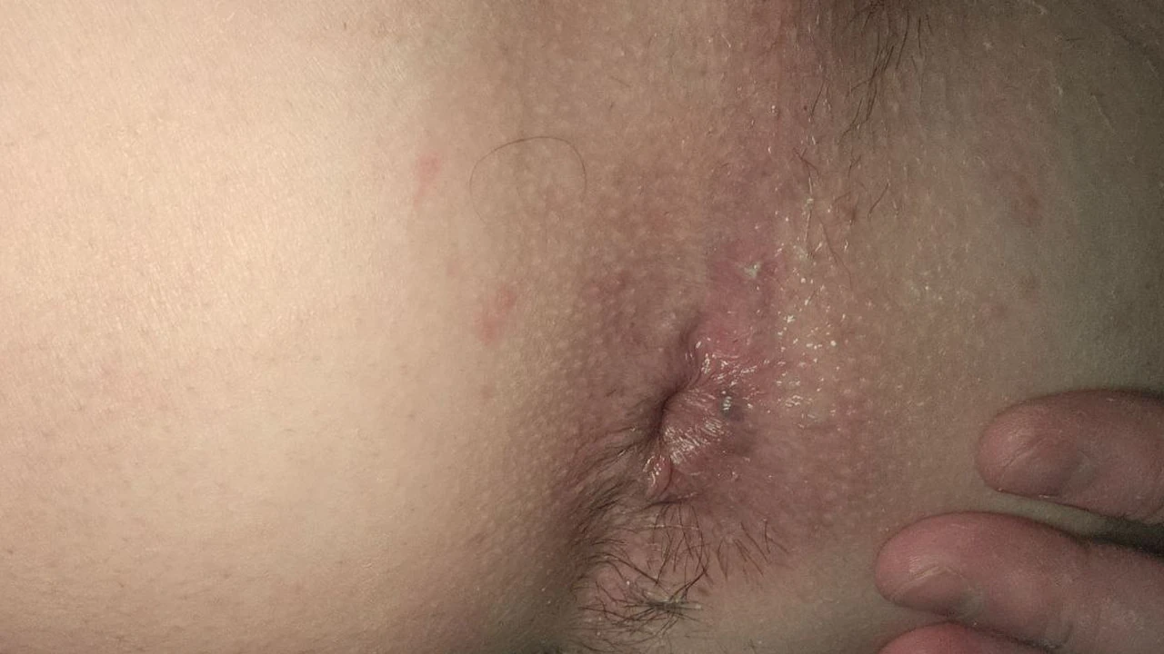 Naughty ass