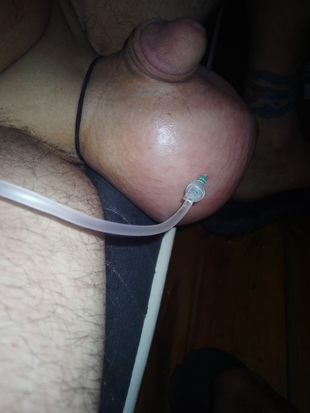 Getting a good stretching in with 3l of saline  #6