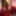 4k Extreme Black Sex Msnovember #5 Big Cock Anal Brutal Fuck