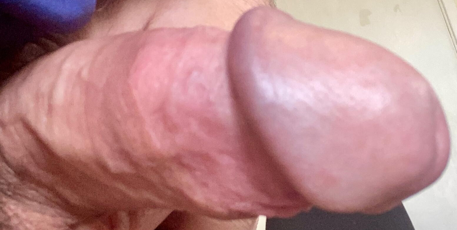 Needs attention #3