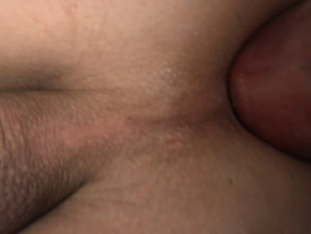 Anal masturbation 