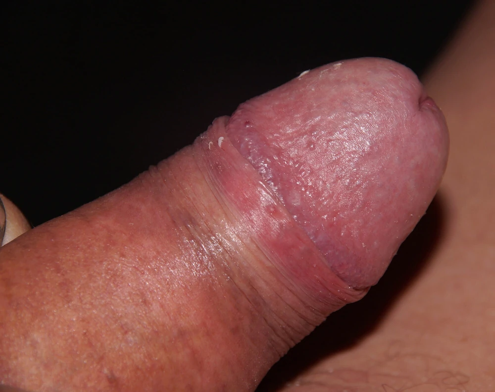 My Hubby prick #5