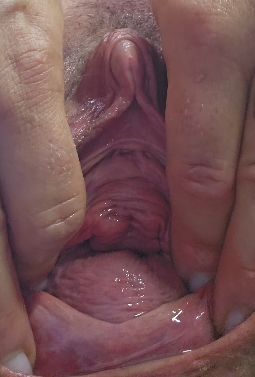Closeup of my squirting prolapse pussy and a fucked urethral #10