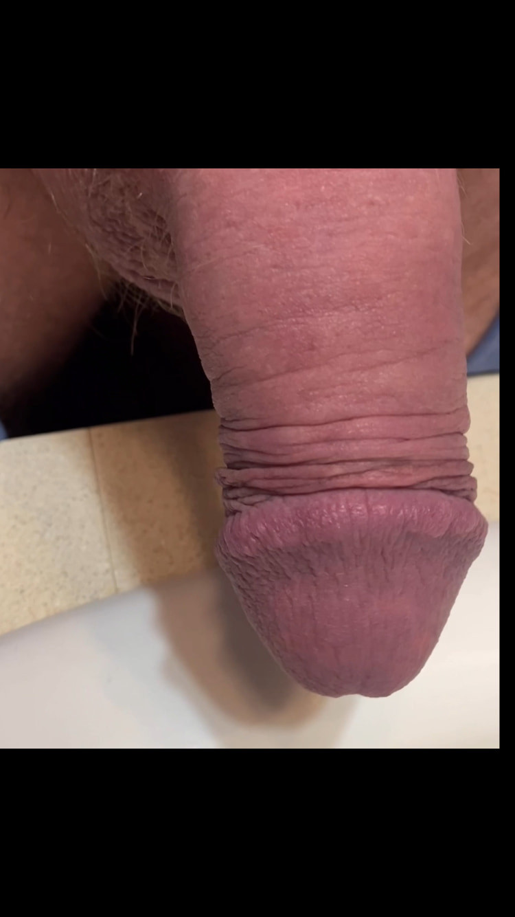 Compilation of uncut cock pics #27