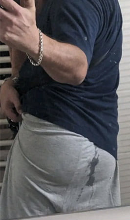 Χύσιμο κώλου