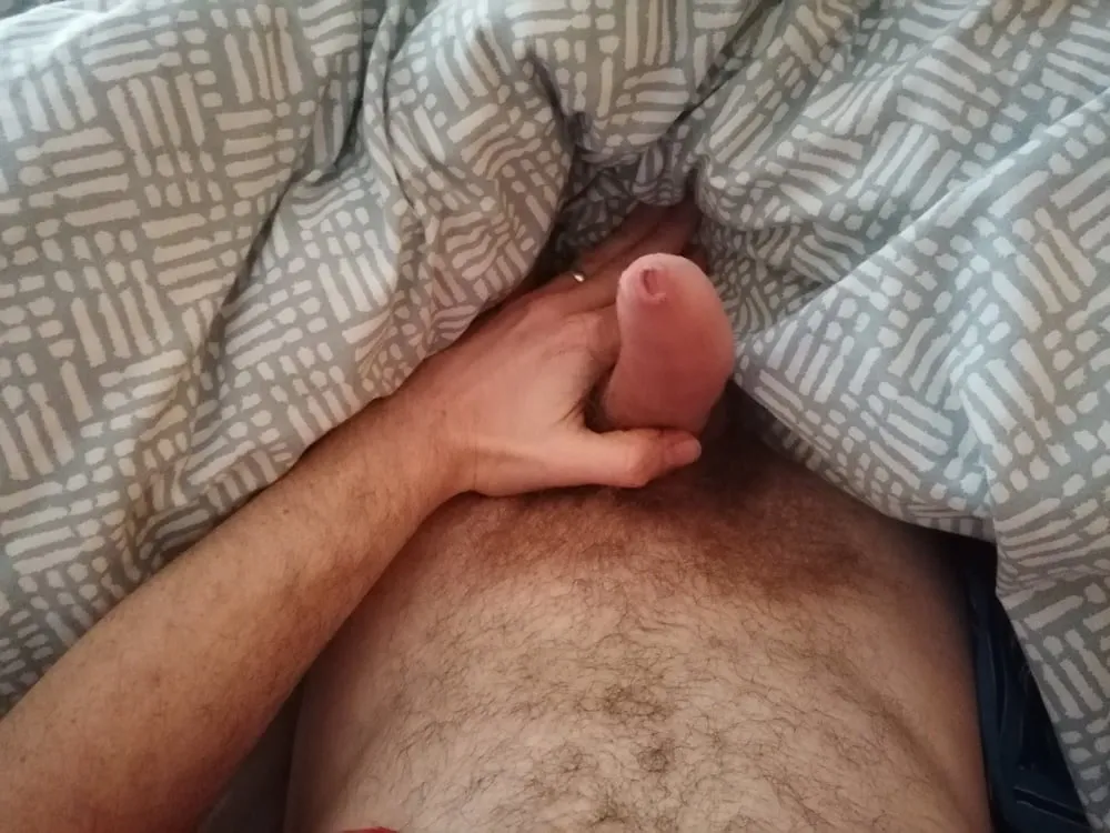 My Phimosis Cock