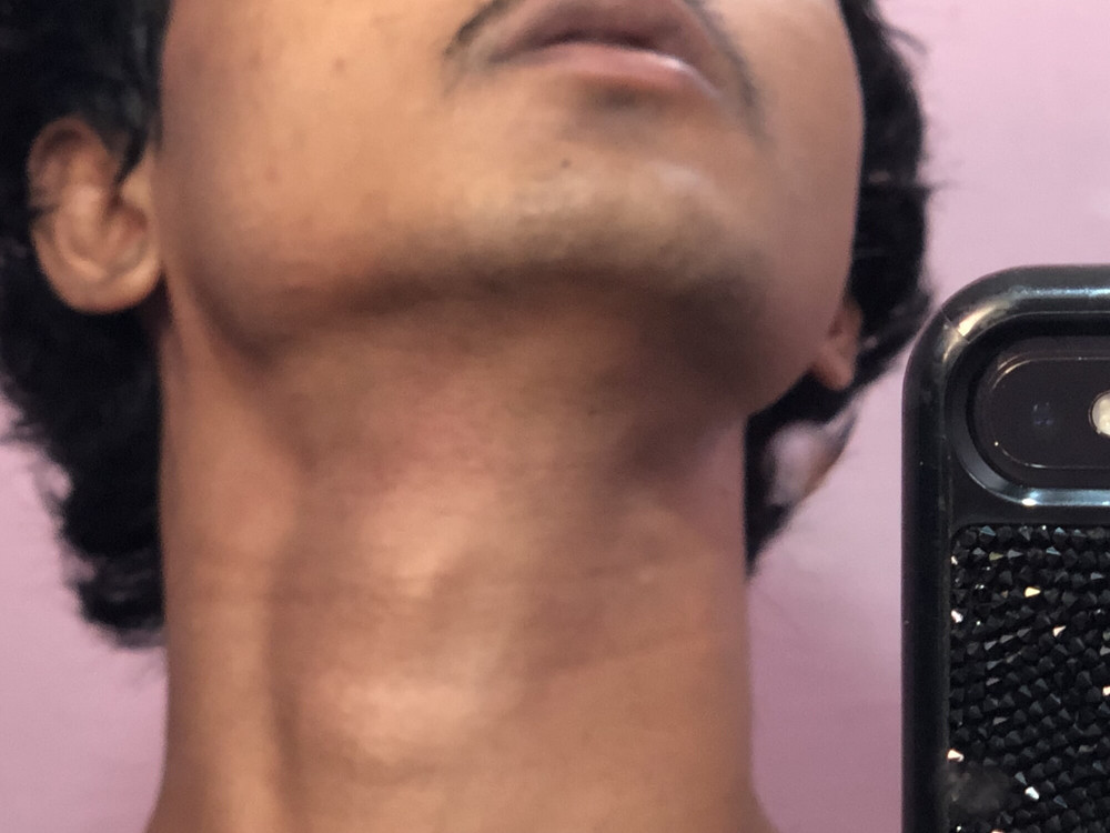 Pics of my slim  body  #18