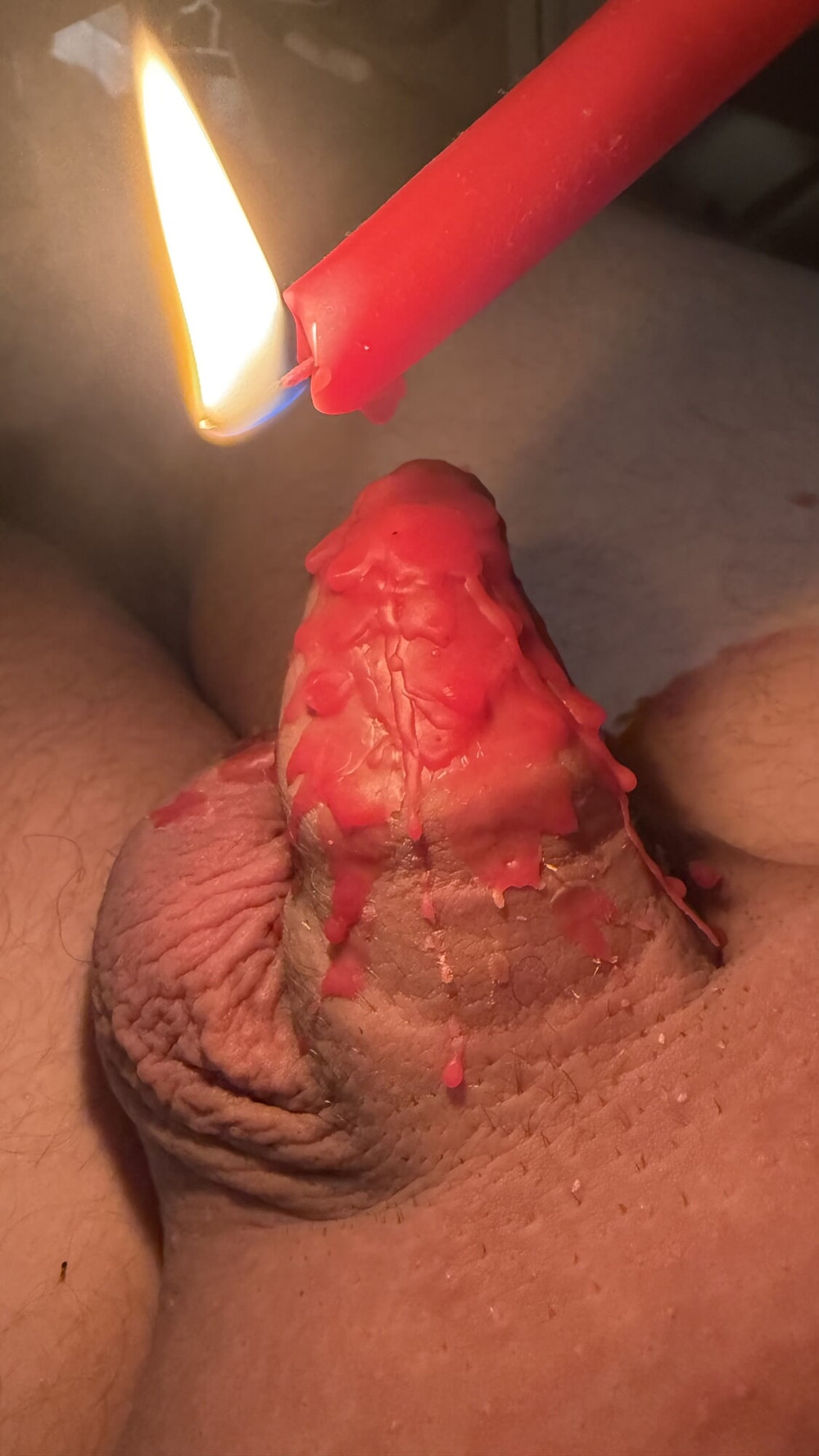 foreskin closed with candle wax #2