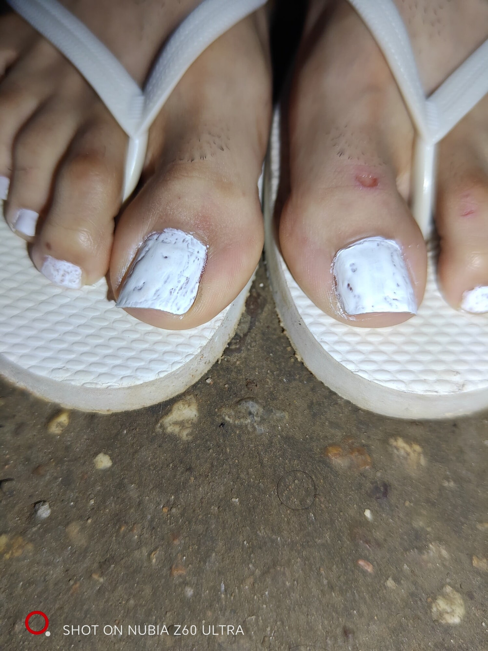 Feet CsG 1.1 #12