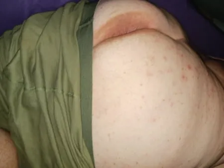 Plump ass white male