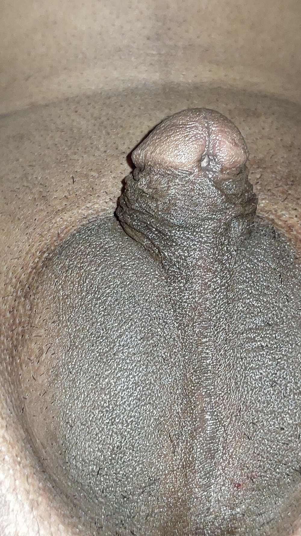 Micro penis #39