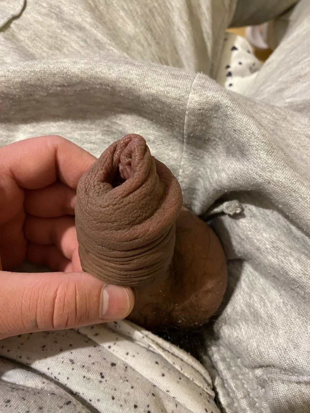 extended foreskin #6