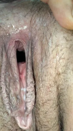 Cum covered cervix 