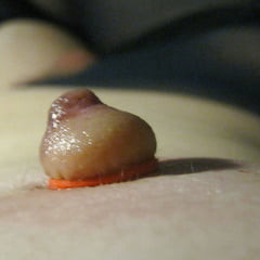 Suction