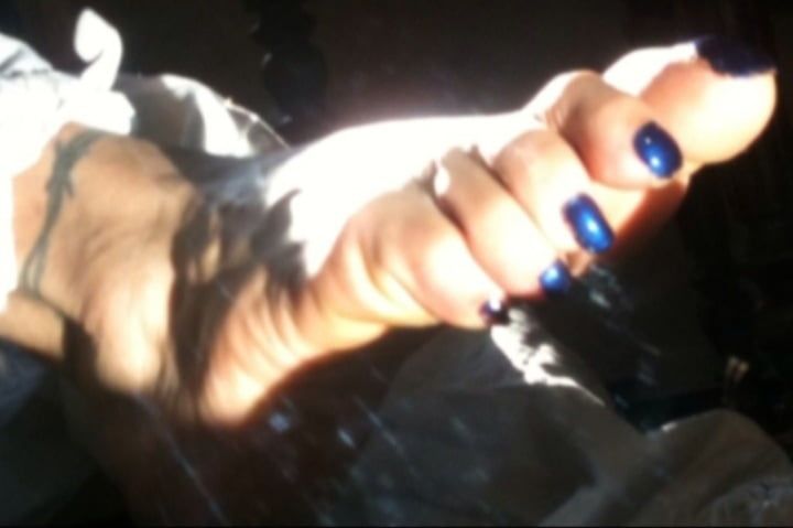 Blue toenails under sun ray #17