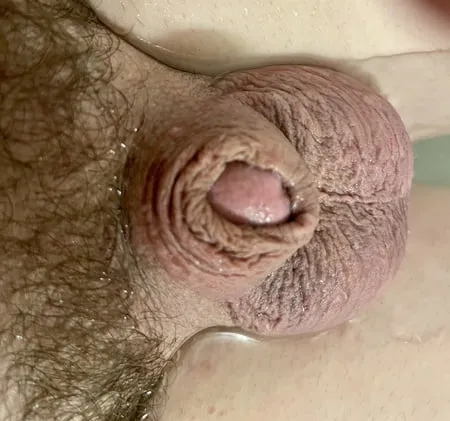 micro penis         