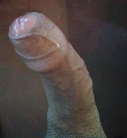 My foreskin up #4