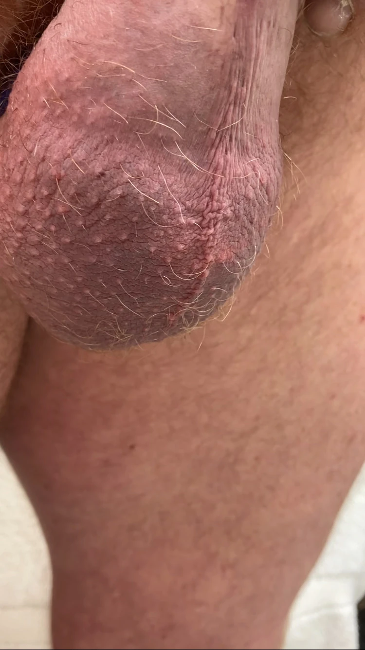 Compilation of uncut cock pics #6