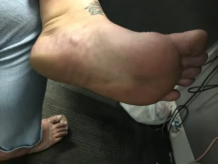 bbw flat feet         