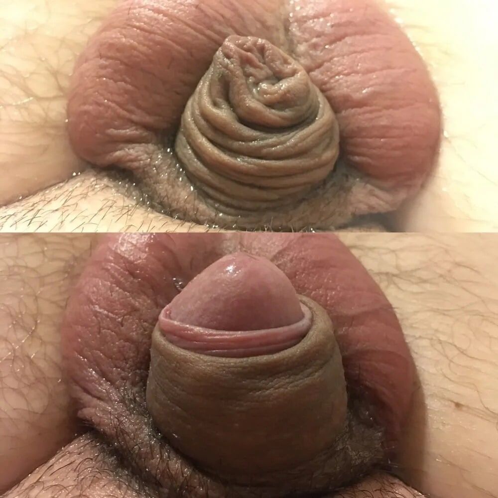 My micropenis  #3