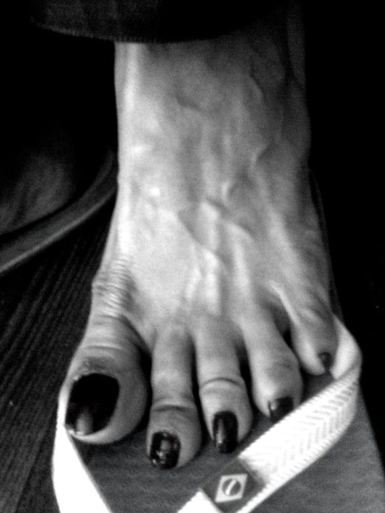 Asian ts feets, soles, toenails mix #57