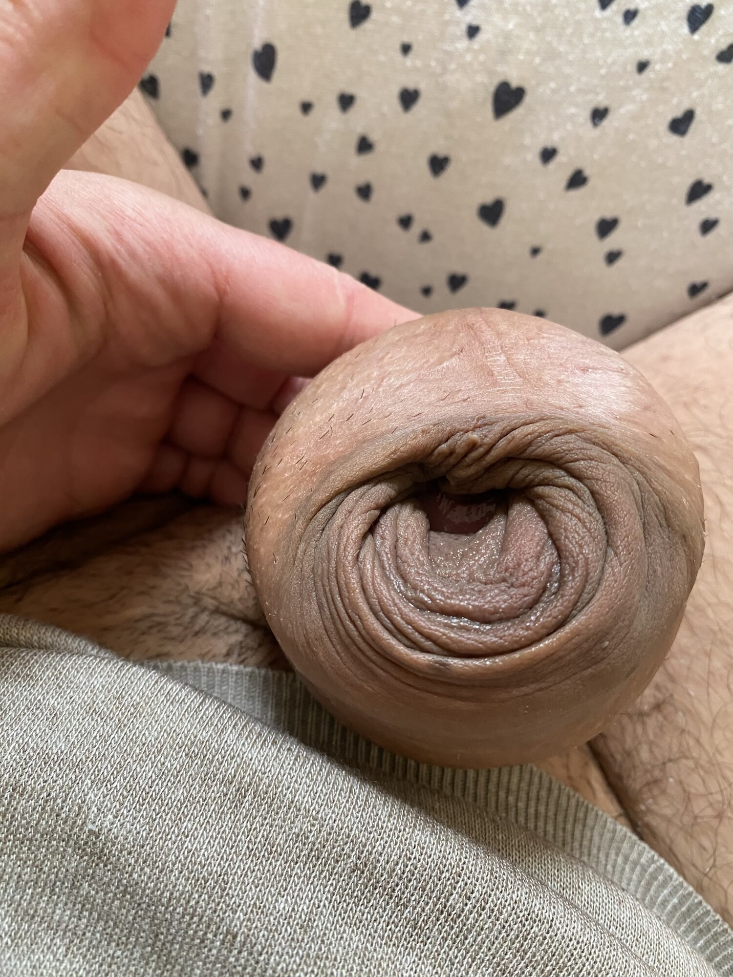 Donut ring foreskin porn
