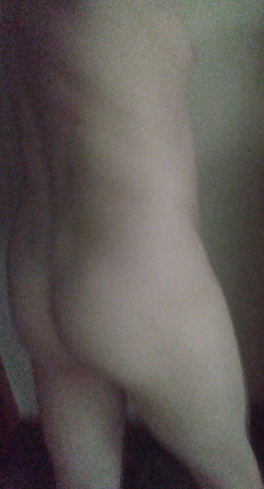 my pale white ass #2