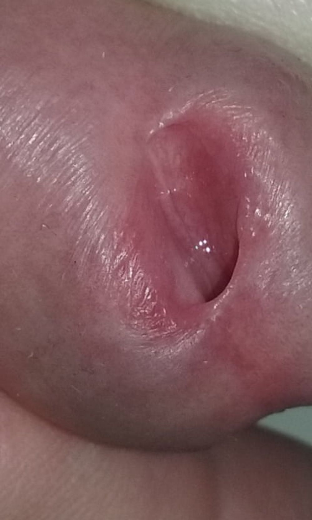 my Kiss Hole #6