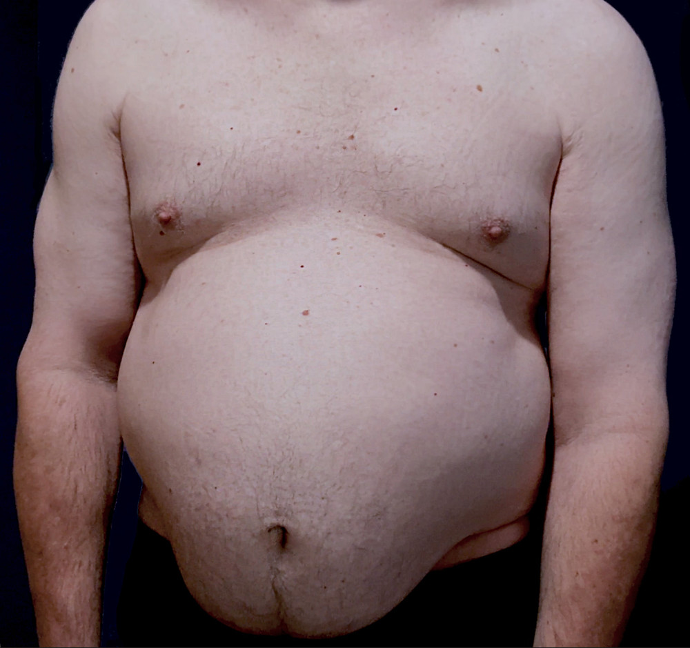 Ximd9000 Big Bloated Belly #18
