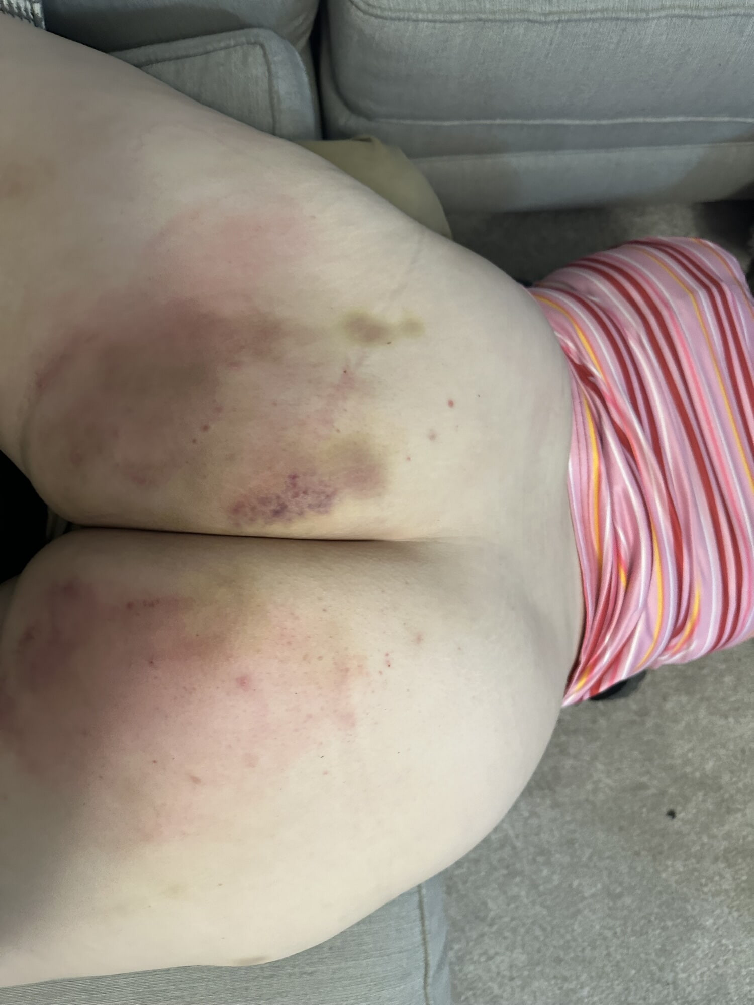 october 26 2025 spanked ass and figging photos #17